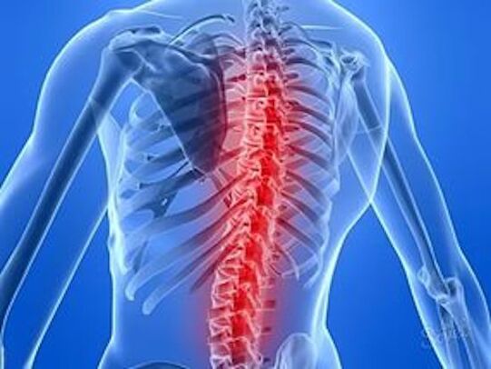 enfermidade da columna vertebral causa dor nas costas
